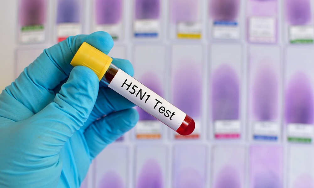 h5n1 test - Illustration Propagation d&rsquo;Influenza chez les vaches aux USA